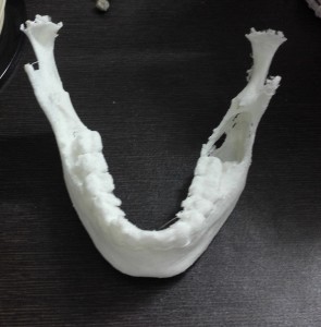 CT scanned 3d printed jaw