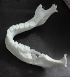 CT scanned 3d printed jaw